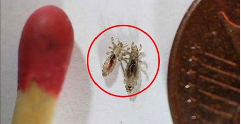 DOCTORS WON’T TELL YOU THIS – CHEAP WAY TO GET RID OF THE HEAD LICE ALMOST INSTANTLY