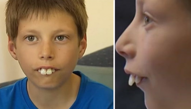 Boy bullied for his teeth gets a new smile with some help from a loving community